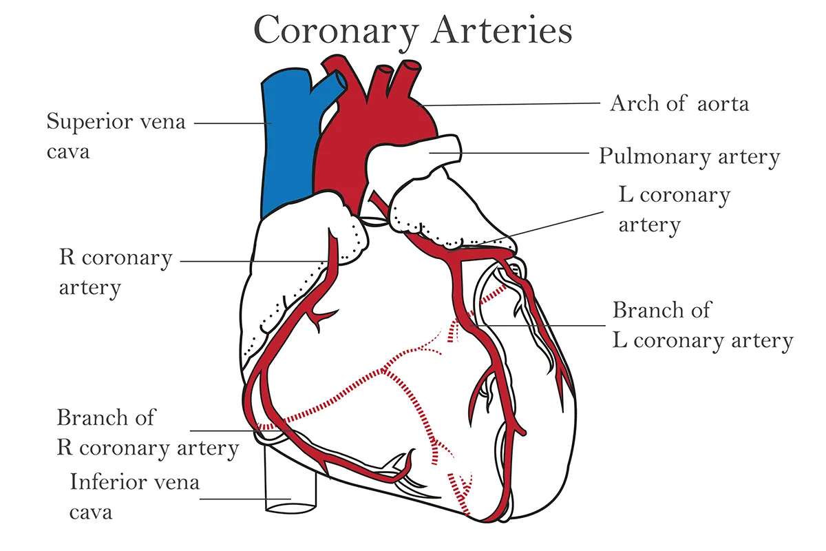 Diagram of a healthy heart showing coronary arteries, aorta, vena cavae and pulmonary arteries. Dashed lines show where arteries wrap around the back of the heart.